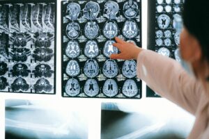 cerveau Médecins analysant des images de cerveaux